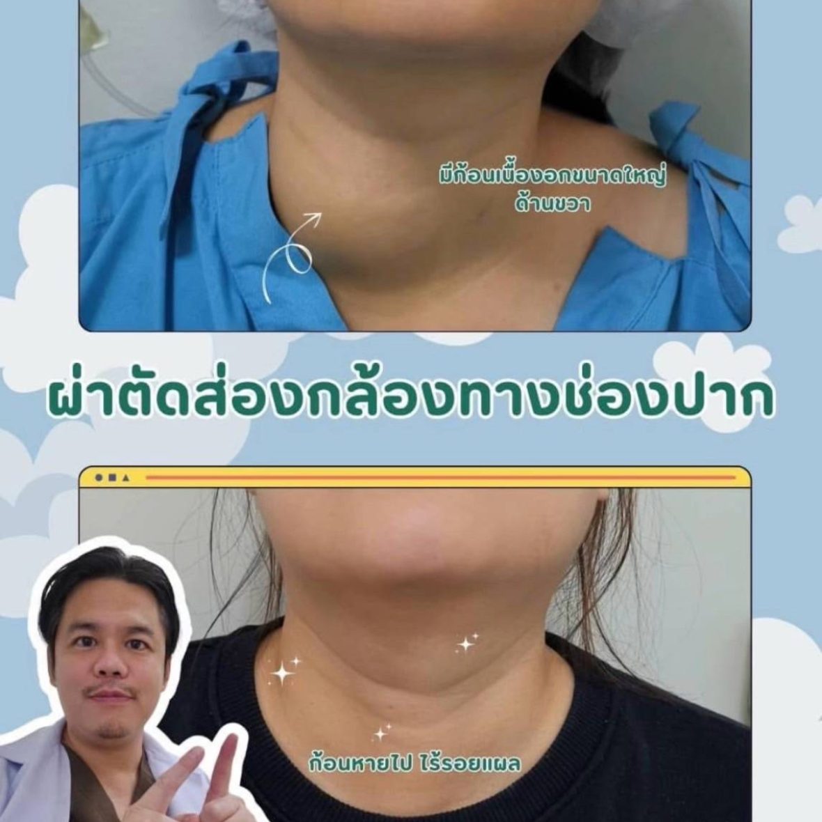 line_oa_chat_250311_171815_group_0